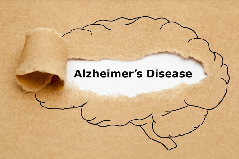 Clipart of a hand-drawn brain with the title "Alzheimer's Disease"