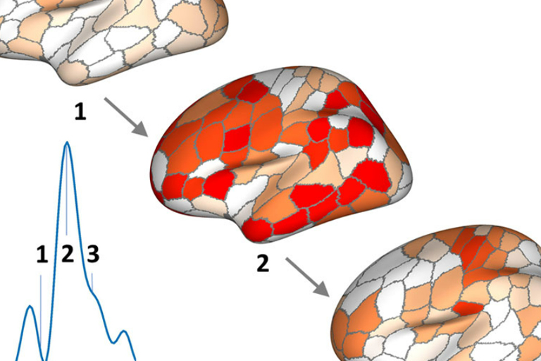 A visualization of a model of mysterious brain events potentially linked to brain disorders